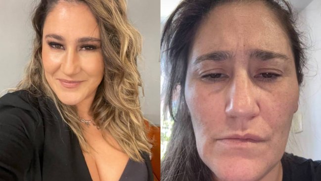 Belén Mora revela complejo problema de salud: «Pensé que iba a morir»